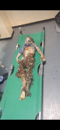 Very graphic images of the children killed in Israeli strikes on Al Shati camp on May 15th, 2021. (Image posted by @EyadKandeel1)