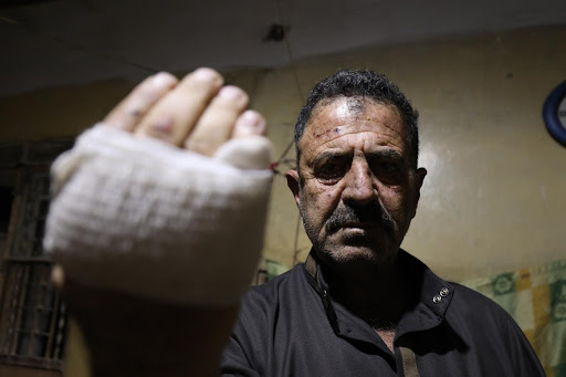 Ahmed Qasoum was reported to be one of at least six members of the Qasoum family who sustained injuries after a US military strike hit a road in Idlib, December 3rd 2021. Image via Middle East Eye/Izzeddin Kasim.