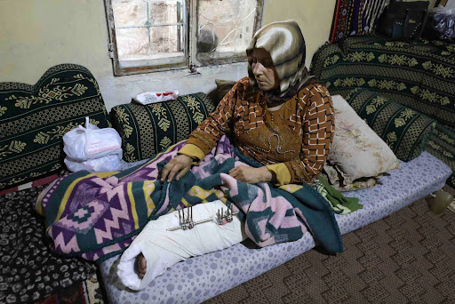 "The wife of Ahmed Qasoum resting her broken leg after being injured in a US attack near Idlib on 3 December", Image via Middle East Eye/Izzeddin Kasim.
