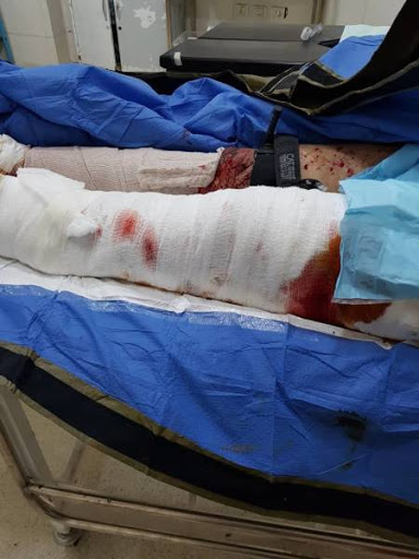Injuries of the attack (via ANHA)