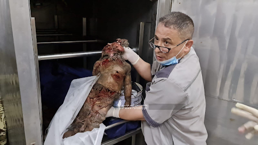 Very graphic image of a child allegedly killed in strikes on Al Jeniya neighborhood on May 13, 2021. (Image posted by Paltoday News)