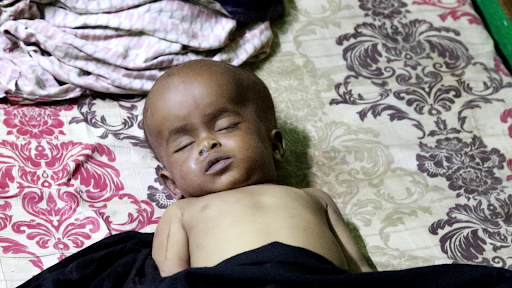 Civilian injured by alleged Kenyan airstrikes on Jilib on August 15, 2023. (Image posted by @xuquuqda1)