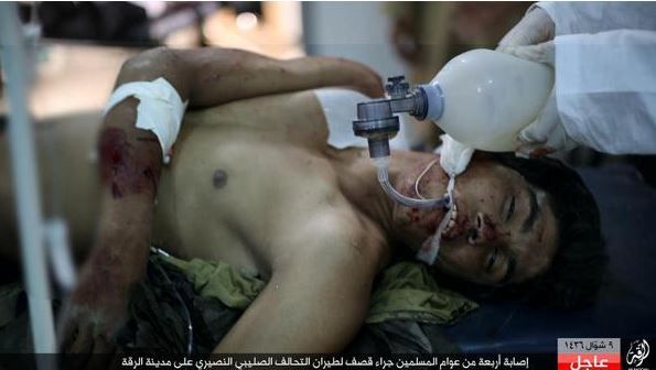 A child being treated in the local hospital following an alleged Coalition strike July 25th 2015 (via raqaa is Being Slaughtered Silently)