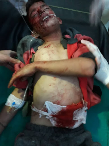 Most of those killed and injured in the alleged Turkish strike on Tal Rifaat, Dec 2nd 2019, are children (via SOHR).