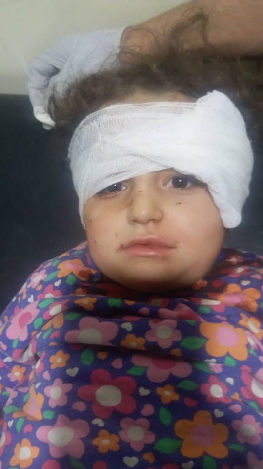Image Caotion Translation: "Civilians wounded due to warplanes shelling with vacuum missiles residential neighborhoods of Ma'rat Al-Nu`man city in Southern Idlib countryside" (via Macro Media Center)