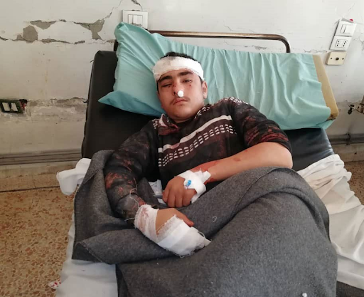 A civilian injured in alleged Israeli airstrikes on locations in Hama on January 22nd, 2021. (via @SyriawatanNews).