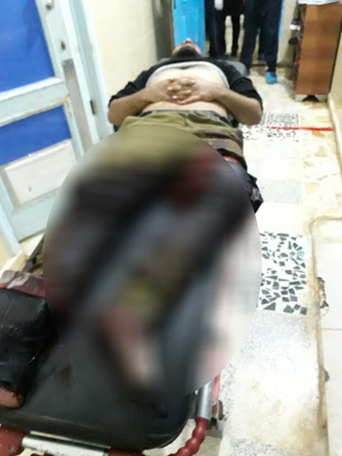 A civilian injured in an alleged Turkish attack on Tal Rifaat on Dec 2nd, 2019 (via ANHA).