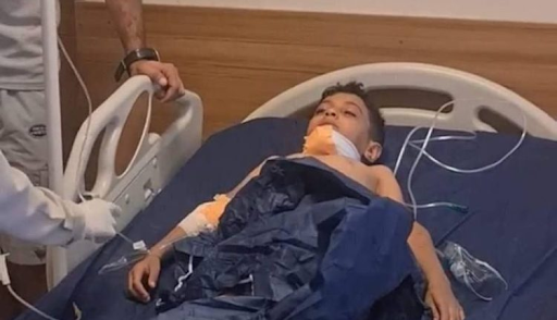 Very graphic image of one of the children injured in the alleged Turkish artillery shelling that hit a touristic site in Kurdistan Region’s Duhok province on July 17, 2022. (Image posted by Almaalomah)