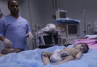 Alleged victim of NATO airstrikes in Majer on August 8th, 2011 (via Zliten Majer Massacre)