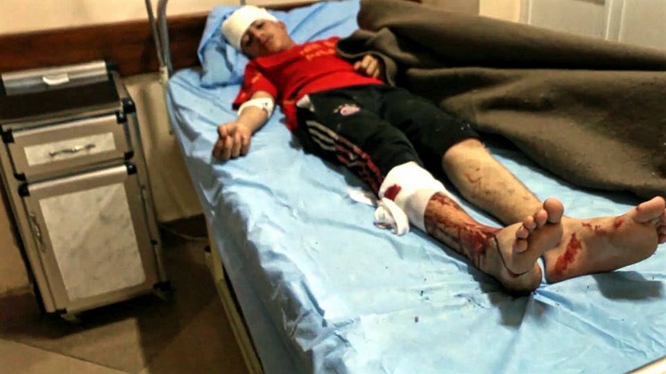 An image shows an injured child followed an alleged Coalition strike at Wadi Hajar, March 27th (via NRN News)