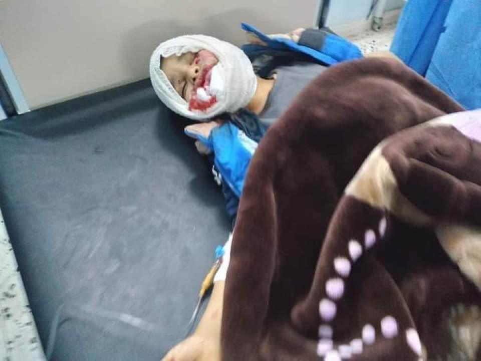 10-year-old Muhammad al-Abed Saleh in the hospital after a mortar landed on a gathering of people celebrating Libya revolution anniversary in Manshiya on February 16th, 2021. Muhammad was reported dead after. (image via Libya Observer).