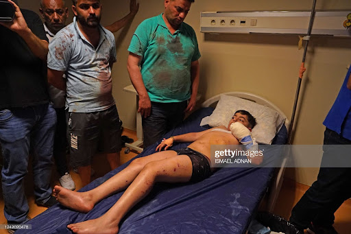 An injured boy receives treatment at a hospital following Turkish shelling in the city of Zakho in the north of Iraq's autonomous Kurdish region on July 20, 2022. - Nine civilians including children were killed in a park in Iraq's autonomous Kurdistan region by artillery fire that Baghdad blamed on neighbouring Turkey, a country engaged in a cross-border offensive. (Photo by Ismael ADNAN / AFP) (Photo by ISMAEL ADNAN/AFP via Getty Images)