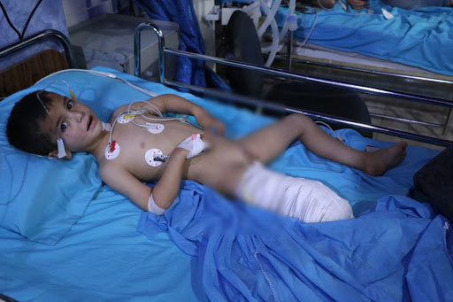 A child injured in an alleged Turkish attack on Tal Rifaat. Dec 2nd 2019 (via ANHA)