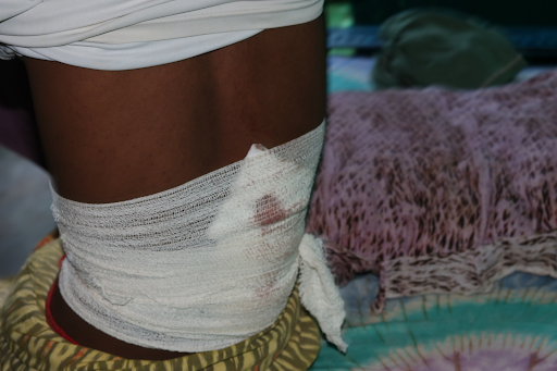 Civilian injured by alleged Kenyan airstrikes on Jilib on August 15, 2023. (Image posted by @xuquuqda1)