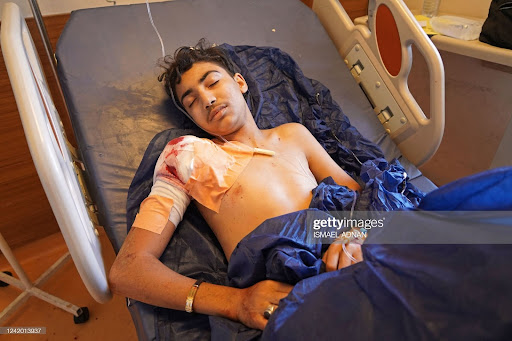 An injured man lies on a hospital bed following Turkish shelling in the city of Zakho in the north of Iraq's autonomous Kurdish region on July 20, 2022. (Photo by Ismael ADNAN / AFP) (Photo by ISMAEL ADNAN/AFP via Getty Images)