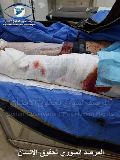 One of the civilians injured in the attack (via SOHR)