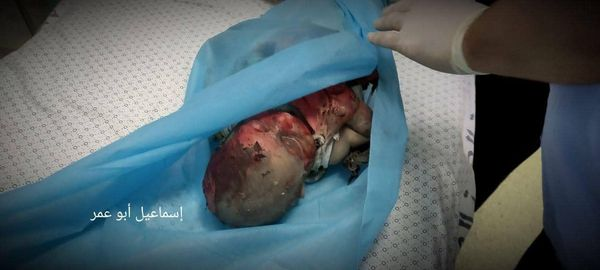 Source: Al Refai Muntasir