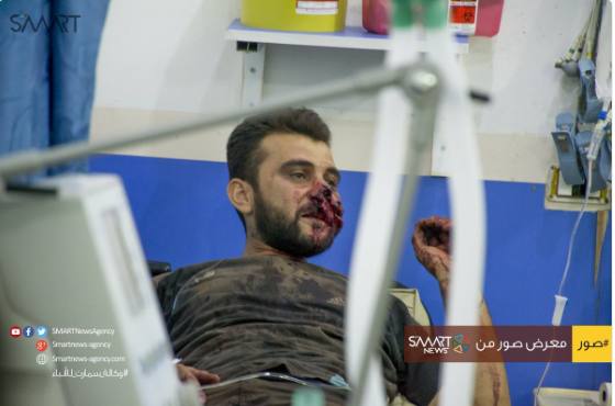 Graphic photographs of the wounded following alleged Russian raids on the oil market (via Smart)