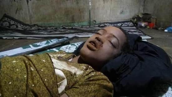 Picture of alleged victim of US airstrike on Jilib on July 29h, 2020 (via Hon Siciid Ibnu dhakhtar)