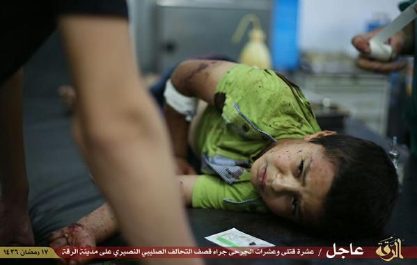 A young surivor of a reported US airstrike receives medical attention, July 4 2015 (via Raqaa is Being Slaughtered Silently))