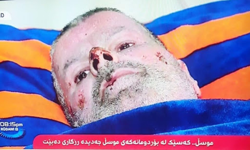 A man allegedly found under rubble four days after the attack (via Women of Mosul)