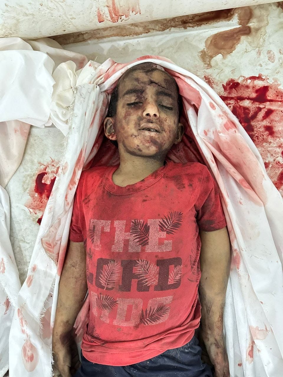 صفحة خدمة مرضي أطفال فلسطين