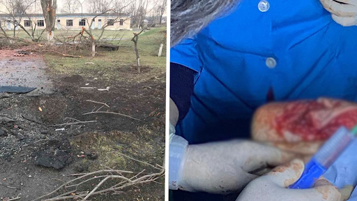 Damage and a graphic image of an injured civilian caused by alleged Russian shelling of Zolochiv on April 6, 2022. (Image posted by Suspilne News)