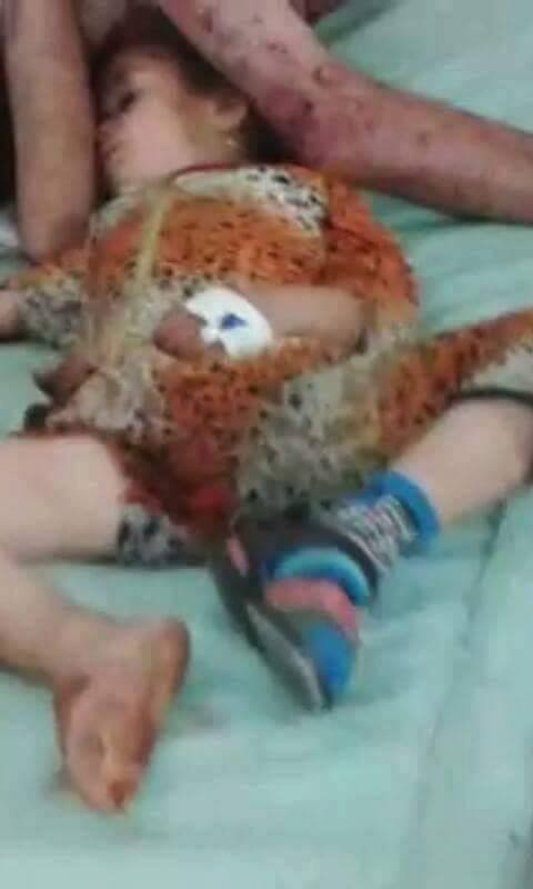 Another picture of the same child who was killed following an alleged Coalition strikes on Fallujah, June 15th (via AlFalujahNews)