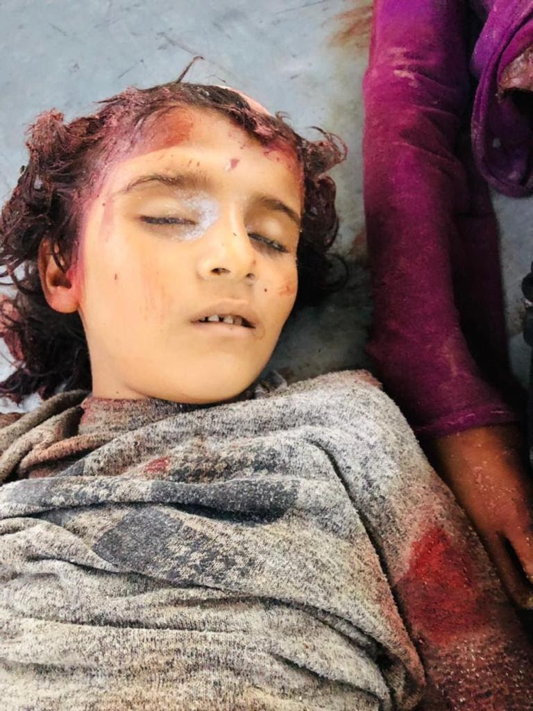 Very graphic image of the children killed in alleged Turkish strikes on Ain Issa on July 4, 2021. (Image posted by the Syrian Democratic Forces)