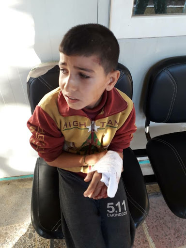 A child injured in an alleged Turkish attack on Tal Rifaat on Dec 2nd, 2019 (via ANHA).