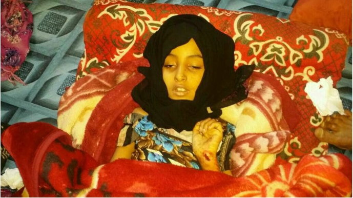 Eight-year-old Nawar al-Awlaki was reportedly fatally wounded after US forces fired upon the house she was hiding in during the raid. Photos of her body, shown here, circulated online after the raid. (Alshahed News, January 29th 2017)