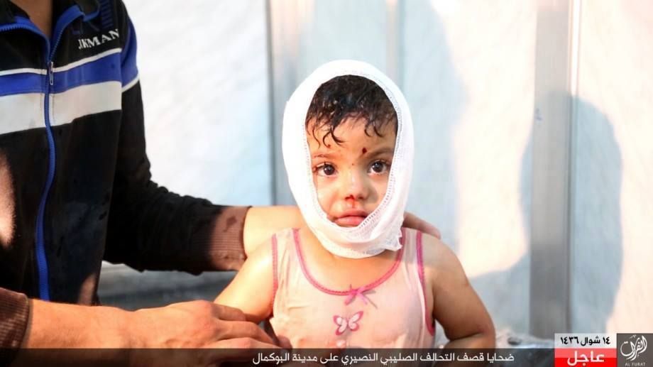 Child victim of a reported Coalition strike at Bukamal, Syria on July 30 2015 (via SN4HR)