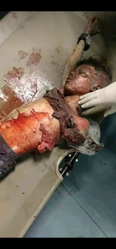 Very graphic images of the children killed in Israeli strikes on Al Shati camp on May 15th, 2021. (Image posted by @EyadKandeel1)