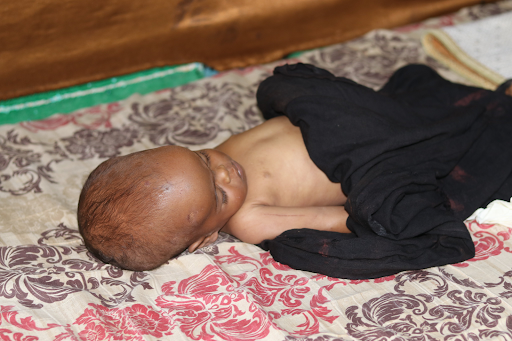 Civilian injured by alleged Kenyan airstrikes on Jilib on August 15, 2023. (Image posted by @xuquuqda1)
