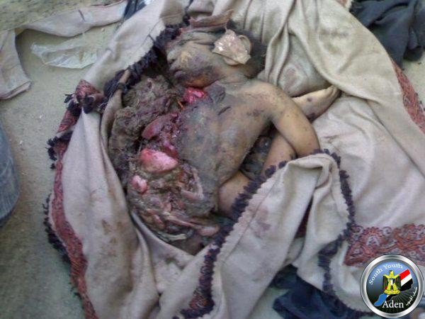 Unexploded cluster munitions, which may have held incendiary material, continued to kill civilians years after the strike (Arabsgate, January 28th 2011)