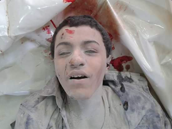 Allegedly a child victim of the aerial strikes at al-Quds Hospital in al-Sukkari, Aleppo