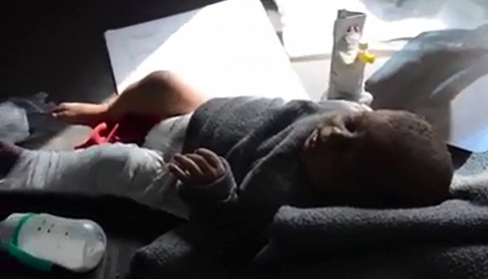A badly njured child - reportdly the only surviving member of hs family after a likely coalition airstrike on Ber Mahli, Syria April 30 2015 (SNHR)
