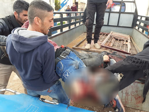 A civilian injured in an alleged Turkish attack on Tal Rifaat on Dec 2nd, 2019 (via ANHA).