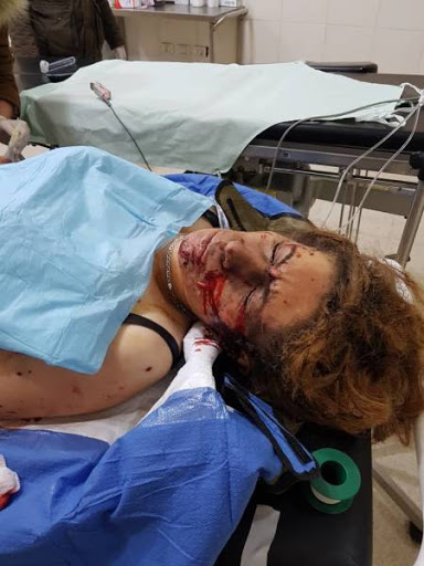 Injuries of the attack (via ANHA)