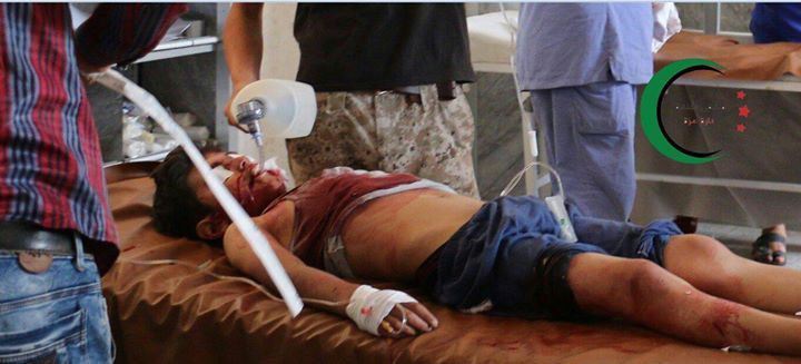 Talal Mohammad Bazar, shortly before his death from injuries sustained n an alleged Russian airstrike, Oct 7th 2015 (via al Kanana Hospital)