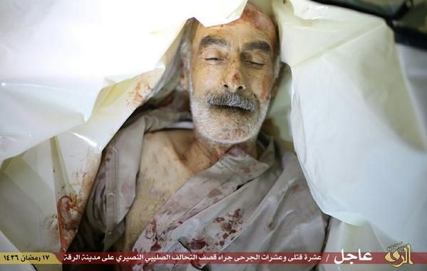 An elderly civilian male, reportedly a victim of a US airstrike on Raqaa, Syria July 4 2015 ((via Raqaa is Being Slaughtered Silently)
