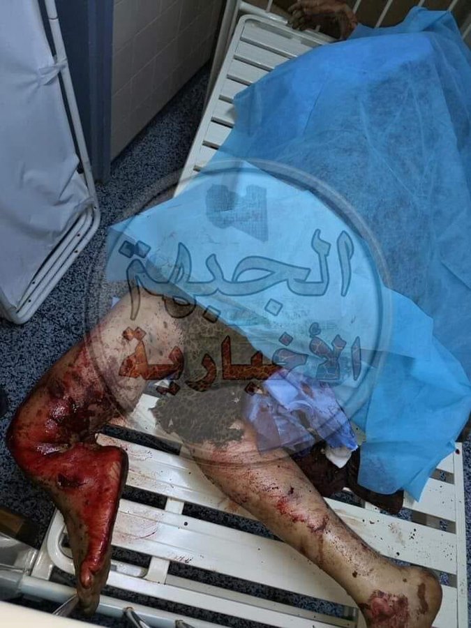 Victm of alleged GNA/Turkish strike on Qasr BIn Gashir on June 3rd, 2020 (via Libyan Review)