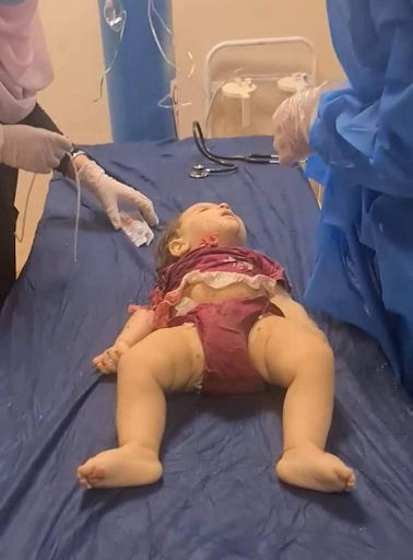 Very graphic image of one of the children injured in the alleged Turkish artillery shelling that hit a touristic site in Kurdistan Region’s Duhok province on July 17, 2022. (Image posted by Almaalomah)