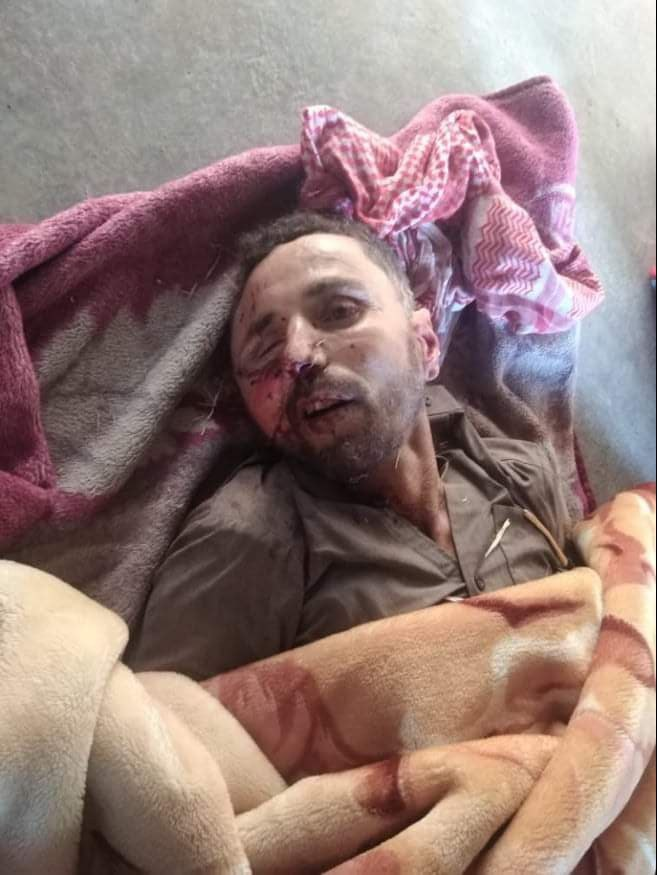 Graphic image of Mutaib Sherida Al-Ghadeer, who was killed in a raid in the town of Thiban on July 16, 2021. (Image posted by @YusufAd76532779)