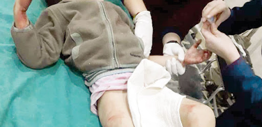 Many children were killed and injured in the alleged Turkish attack on Tal Rifaat (via Politika)