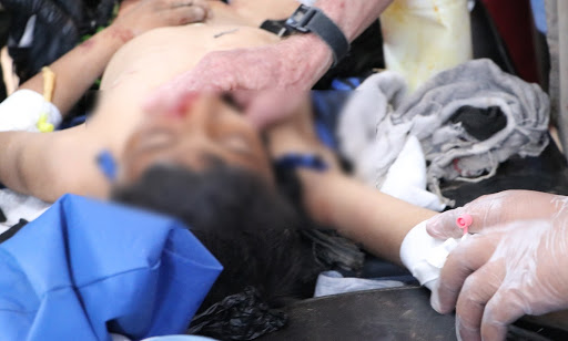 Hatem Hazem, a child died of his injuries sustained as a result of a Turkey or pro-Turkey militants shelling on Ain Issa on October 16th, 2020. (via ANHA)