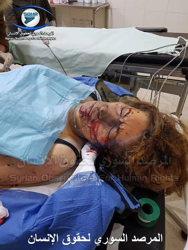 One of the civilians injured in the attack (via SOHR)