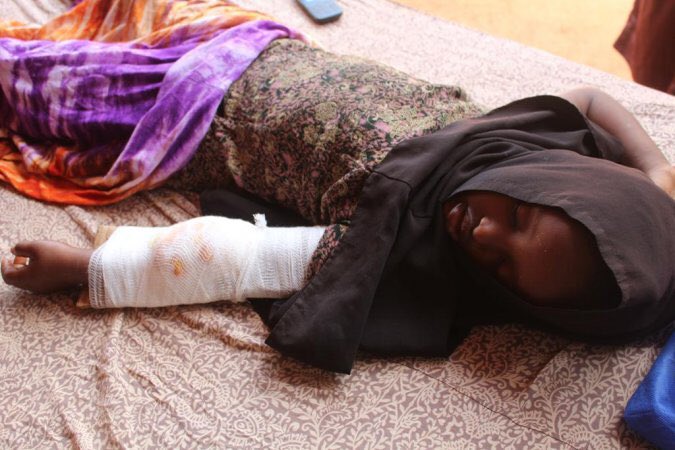 Picture of an alleged victim of US strike on Kunya Barrow on May 17th, 2020 (via Halgan Media)