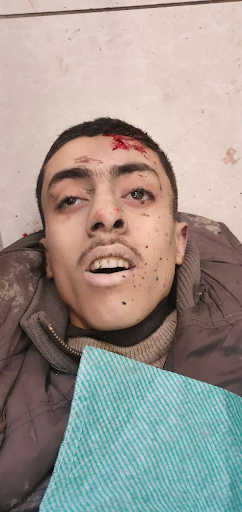 Graphic images of the dead and injured were uploaded online by @Almohrar1 (Image via Twitter)