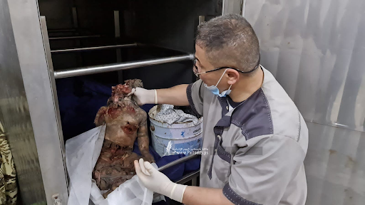 Very graphic image of a child allegedly killed in strikes on Al Jeniya neighborhood on May 13, 2021. (Image posted by Paltoday News)